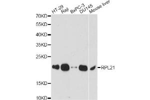 Western blot analysis of extracts of various cell lines, using RPL21 antibody.