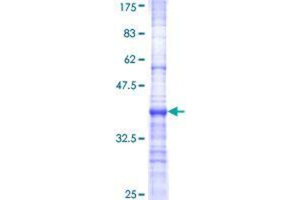 BTBD9 Protein (AA 2-70) (GST tag)
