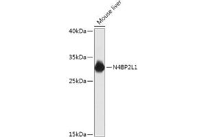 Western blot analysis of extracts of Mouse liver, using N4BP2L1 antibody (ABIN7268840) at 1:1000 dilution. (N4BP2L1 Antikörper  (AA 40-120))