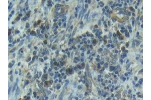 Immunohistochemistry (IHC) image for anti-Interleukin 1 Receptor, Type I (IL1R1) (AA 21-109) antibody (ABIN7430735)