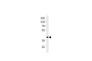 DANRE hoxd11a Antibody (Center) Azb10017a western blot analysis in zebra fish heart tissue lysates (35 μg/lane). (HOXD11 Antikörper  (AA 128-155))