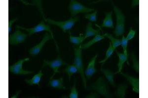 Immunofluorescent staining of HeLa cells using anti-UCK1 mouse monoclonal antibody (ABIN2453770). (UCK1 Antikörper)
