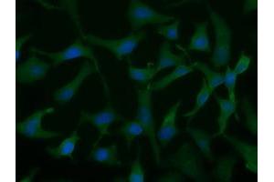 Immunofluorescent staining of HeLa cells using anti-UCK1 mouse monoclonal antibody (ABIN2453770).