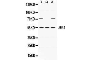Western blot analysis of ABAT expression in rat brain extract ( Lane 1), mouse testis extract ( Lane 2) and HEPG2 whole cell lysates ( Lane 3).