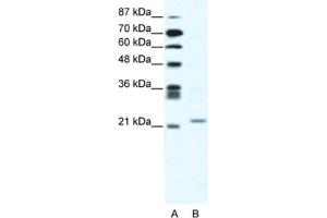 Western Blotting (WB) image for anti-Twist Homolog 1 (Drosophila) (TWIST1) antibody (ABIN2461623) (TWIST1 Antikörper)