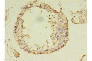 Immunohistochemistry of paraffin-embedded human testis tissue using ABIN7144183 at dilution of 1:100