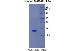 SDS-PAGE (SDS) image for Solute Carrier Family 3 (Activators of Dibasic and Neutral Amino Acid Transport), Member 2 (SLC3A2) (AA 213-349) protein (His tag) (ABIN1981159) (SLC3A2 Protein (AA 213-349) (His tag))