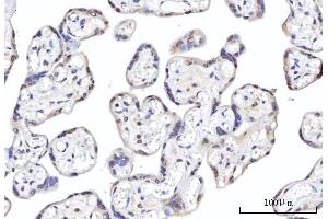 IHC analysis of RBM22 using anti-RBM22 antibody (ABIN7600268). (RBM22 Antikörper  (AA 17-406))