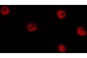 ABIN6277434 staining HepG2 by IF/ICC. (TCF7 Antikörper)