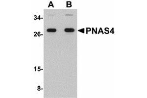 Image no. 1 for anti-PPPDE Peptidase Domain Containing 1 (PPPDE1) (C-Term) antibody (ABIN478034) (PPPDE1 Antikörper  (C-Term))