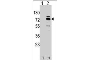 Western blot analysis of Arhgef9 (arrow) using rabbit Arhgef9 polyclonal antibody . (Arhgef9 Antikörper  (AA 281-311))