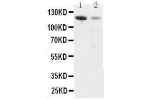 Anti-Integrin alpha 3 antibody, Western blotting Lane 1: Rat Heart Tissue Lysate Lane 2: HELA Cell Lysate