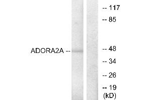 Immunohistochemistry analysis of paraffin-embedded human brain tissue using ADORA2A antibody. (Adenosine A2a Receptor Antikörper  (Internal Region))