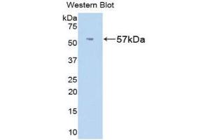 Western Blotting (WB) image for anti-Fibrinogen beta Chain (FGB) (AA 33-479) antibody (ABIN1174356)