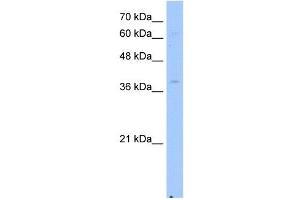 NSDHL antibody used at 2. (NSDHL Antikörper)