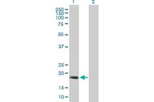 Western Blot analysis of C17orf49 expression in transfected 293T cell line by C17orf49 MaxPab polyclonal antibody. (C17orf49 Antikörper  (AA 1-172))