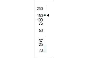 Western Blotting (WB) image for anti-Insulin-Like Growth Factor 1 Receptor (IGF1R) (AA 1335-1366), (C-Term) antibody (ABIN6242851)