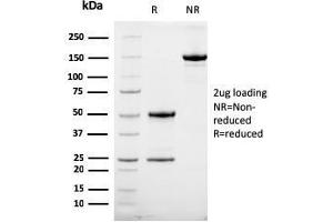 SDS-PAGE Analysis Purified HER-2 Mouse Monoclonal Antibody (HRB2/258). (ErbB2/Her2 Antikörper  (Extracellular Domain))