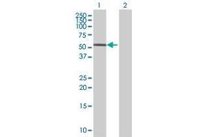 Lane 1: MEIS1 transfected lysate ( 41. (MEIS1 293T Cell Transient Overexpression Lysate(Denatured))