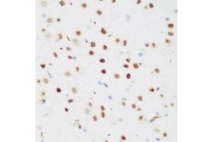 Immunohistochemistry of paraffin-embedded mouse brain using CSRNP1 antibody at dilution of 1:200 (40x lens). (AXUD1 Antikörper)