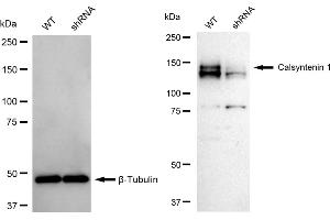 Western blotting analysis using Calsyntenin 1 antibody (ABIN7797854). (Rekombinanter Calsyntenin 1 Antikörper)
