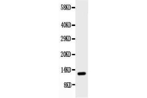 Anti-Estrogen Inducible Protein pS2 antibody, Western blottingWB: Rat Stomach Tissue Lysate (TFF1 Antikörper  (Middle Region))