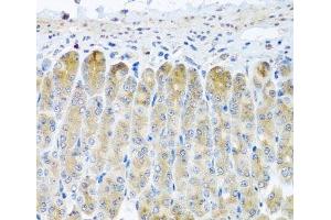 Immunohistochemistry of paraffin-embedded Mouse stomach using TAMM41 Polyclonal Antibody at dilution of 1:100 (40x lens). (TAM41 Antikörper)