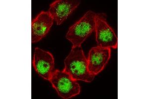 Immunofluorescence (IF) image for anti-Cyclin-Dependent Kinase Inhibitor 1C (p57, Kip2) (CDKN1C) (AA 34-64), (N-Term) antibody (ABIN654899)