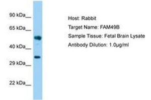 Image no. 1 for anti-Family with Sequence Similarity 49, Member B (FAM49B) (AA 22-71) antibody (ABIN6750181) (FAM49B Antikörper  (AA 22-71))