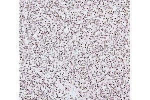 IHC analysis of NRF1 using anti-NRF1 antibody (ABIN7600874). (NRF1 Antikörper  (AA 246-503))