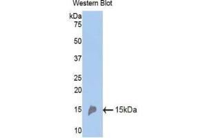 Western blot analysis of the recombinant protein. (Renin Antikörper  (AA 110-221))