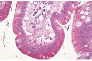 Anti-MARK3 antibody IHC staining of human small intestine. (MARK3 Antikörper  (AA 1-50))