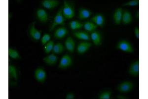 Immunofluorescence staining of A549 cells with ABIN7155179 at 1:200, counter-stained with DAPI. (PDE9A Antikörper  (AA 426-533))