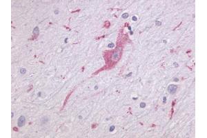 Anti-LPHN1 antibody IHC of human brain, neurons and glia. (Latrophilin 1 Antikörper  (N-Term))
