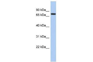 WB Suggested Anti-SNRK Antibody Titration: 0. (SNRK Antikörper  (Middle Region))