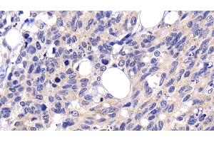 Immunohistochemistry (IHC) image for anti-Caspase 8 (CASP8) (AA 217-384) antibody (ABIN7432745)