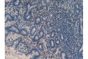 Detection of MMP9 in Human Stomach Tissue using Polyclonal Antibody to Matrix Metalloproteinase 9 (MMP9) (MMP 9 Antikörper  (AA 213-399))