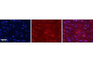 Rabbit Anti-CSK Antibody Catalog Number: ARP52042_P050 Formalin Fixed Paraffin Embedded Tissue: Human Heart Tissue Observed Staining: Cytoplasm in endothelial cells in capillaries Primary Antibody Concentration: 1:100 Other Working Concentrations: N/A Secondary Antibody: Donkey anti-Rabbit-Cy3 Secondary Antibody Concentration: 1:200 Magnification: 20X Exposure Time: 0. (CSK Antikörper  (Middle Region))