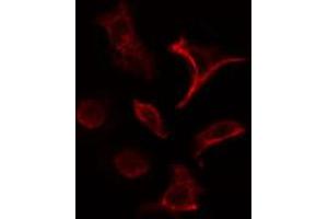 ABIN6266830 staining HeLa cells by IF/ICC. (COL4A1 Antikörper)
