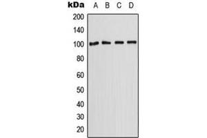 Western blot analysis of OCT2 expression in A431 (A), HepG2 (B), SP2/0 (C), H9C2 (D) whole cell lysates.
