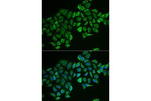 Immunofluorescence analysis of MCF-7 cells using RHOD antibody (ABIN5973862). (RHOD Antikörper)
