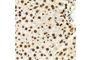 Immunohistochemistry of paraffin-embedded Rat liver using DiMethyl-Histone H3-K27 antibody. (Histone 3 Antikörper  (H3K27me))
