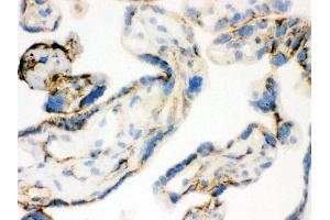 Immunohistochemistry (IHC) image for anti-Transglutaminase 2 (C Polypeptide, Protein-Glutamine-gamma-Glutamyltransferase) (TGM2) (AA 7-34), (N-Term) antibody (ABIN3043946)