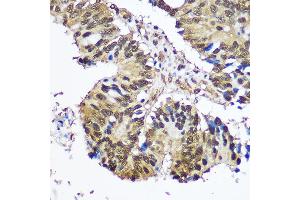 Immunohistochemistry (IHC) image for anti-Ubiquitin-Like Modifier Activating Enzyme 1 (UBA1) (AA 300-600) antibody (ABIN6149765)