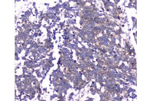 Immunohistochemistry (IHC) image for anti-RAB27A, Member RAS Oncogene Family (RAB27A) antibody (ABIN5647255)