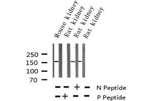 Western blot analysis of Phospho-VEGFR2 (Tyr1214) expression in various lysates (VEGFR2/CD309 Antikörper  (pTyr1214))