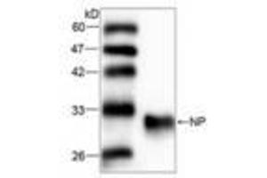 Image no. 1 for anti-Nucleoside Phosphorylase (NP) (AA 68-289) antibody (ABIN791487) (PNP Antikörper  (AA 68-289))