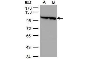 WB Image Sample(30 μg of whole cell lysate) A:293T B:A431, 7. (EEF2 Antikörper)