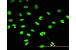 Immunofluorescence of monoclonal antibody to CBX3 on HeLa cell. (CBX3 Antikörper  (AA 1-183))