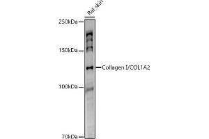 Western blot analysis of extracts of Rat skin, using Collagen I/COL1 antibody (1059) at 1:1000 dilution. (COL1A2 Antikörper)